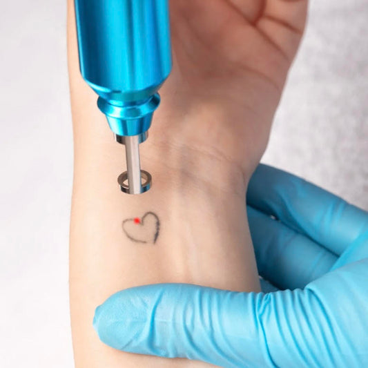 Remoción de Tatuajes Pequeños